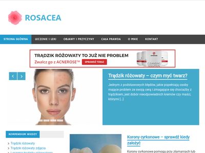 Rosacea.net.pl podpowie jak leczyć trądzik różowaty