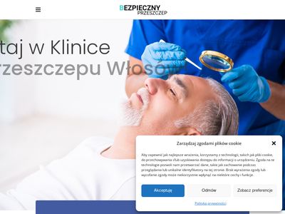 Przeszczep włosów Warszawa. Zakola, łysienie- bezpieczny-przeszczep.pl